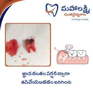 Business Name Mahalakshmi Dental Clinic | Best Dentist, Orthodontic , Dental Implant & Root Canal Centre in Khanapur - Nirmal - Adilabad Address: AMK Function Hall, Road, beside Katta Rajanna Oil Mill & Kirana store, beside Lucky Ladies Emporium, Khanapur, Telangana 504203 Phone: 9502211812,9502811812 Keywords: Mhalakshmi dental clinic in khanapur Mahalakshmi dental clinic in khanapur, Nirmal. Best dental clinics in Khanapur Best Dental Hospitals in Khanapur Top Dentists in Khanapur Best Endodontist Doctors in khanapur Best root canal doctor in khanapur Best maxillofacial surgeon in khanapur Best implantalogist in khanapur Best orthodontist in khanapur Dental hospital near me in khanapur Dental clinic near me in khanapur Top Dental clinic in Khanapur Best Dentist in Khanapur Best Root canal centre in khanapur Best Implant centre in khanapur Best Teeth cleaning clinic in khanapur Best Teeth Whitening clinic in khanapur Best Teeth Extraction clinic in khanapur Best Surgical Extraction clinic in khanapur Best Wisdom tooth Extraction clinic in khanapur Best cement filling clinic in khanapur Best children dental clinic in khanapur Best children dentist in khanapur Best Dental surgeon in khanapur Experienced dentist in khanapur Experienced dental clinic in khanapur Experienced root canal specialist in khanapur Best Root canal centre in khanapur Top Dental Services in khanapur Affordable Dental Implants in khanapur Root Canal Specialist in khanapur Teeth Whitening in khanapur Cosmetic Dentist in khanapur Orthodontistin khanapur Emergency Dental Care in khanapur Family Dentist in khanapur Pediatric Dentist in khanapur Gum Disease Treatment in khanapur clips treatment in khanapur Braces treatment in khanapur Dental Crown and Bridges Hanmakonda Smile Makeover in khanapur Dental Surgery in khanapur Wisdom Teeth Removal in khanapur Dental Implant Surgery in khanapur Dental Health Checkup in khanapur Porcelain Veneersin khanapur Sensitive Teeth Treatment in khanapur Dental Pain Relief in khanapur Dentures in khanapur Dental Fillings in khanapur Advanced Dental Care in khanapur Laser Dentistryin khanapur Dental Care for Seniors in khanapur Description: "Welcome to Mahalakshmi Dental Clinic Khanapur, your premier dental clinic in Khanapur 504203. We specialize in comprehensive dental treatments to ensure your oral health stays top-notch. From routine cleanings and dental check-ups to more advanced procedures like root canal treatments and tooth extractions, our expert team is dedicated to providing the highest standard of care. We also excel in restorative and cosmetic dentistry, helping you achieve a pearly white, confident smile. Using state-of-the-art technology and personalized care plans, Mahalakshmi Dental Clinic Khanapur is committed to your dental health. Visit us for professional, reliable, and affordable dental care in Khanapur ,Nirmal 504203." Facebook: https://www.facebook.com/mahalakshmidentalclinic/ https://www.facebook.com/mahalakshmidental/ Instagram: https://www.instagram.com/mahalakshmidental_khanapur/ THreads: https://www.threads.net/@mahalakshmidental_khanapur Youtube: https://www.youtube.com/@mahalakshmidentalclinic Website : https://mahalakshmidentalclinics.in/ telegram https://t.me/mahalakshmidentalclinic Google maps: https://www.google.com/maps/place/Mahalakshmi+Dental+Clinic+Khanapur+%7C+Best+Dental+Clinic,+Root+Canal+%26+Implant+Centre+in+Khanapur/@19.0407257,78.6510343,16z/data=!4m6!3m5!1s0x3bcd836b81589adb:0x92b6bc623dc1a56e!8m2!3d19.0401422!4d78.6504285!16s%2Fg%2F11vzs6bvmb?entry=ttu Shuru: https://shuru.co.in/services/dental-clinic-in-khanapur-nirmal