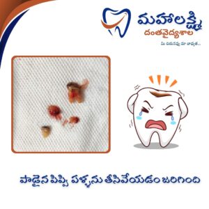 Business Name Mahalakshmi Dental Clinic | Best Dentist, Orthodontic , Dental Implant & Root Canal Centre in Khanapur - Nirmal - Adilabad Address: AMK Function Hall, Road, beside Katta Rajanna Oil Mill & Kirana store, beside Lucky Ladies Emporium, Khanapur, Telangana 504203 Phone: 9502211812,9502811812 Keywords: Mhalakshmi dental clinic in khanapur Mahalakshmi dental clinic in khanapur, Nirmal. Best dental clinics in Khanapur Best Dental Hospitals in Khanapur Top Dentists in Khanapur Best Endodontist Doctors in khanapur Best root canal doctor in khanapur Best maxillofacial surgeon in khanapur Best implantalogist in khanapur Best orthodontist in khanapur Dental hospital near me in khanapur Dental clinic near me in khanapur Top Dental clinic in Khanapur Best Dentist in Khanapur Best Root canal centre in khanapur Best Implant centre in khanapur Best Teeth cleaning clinic in khanapur Best Teeth Whitening clinic in khanapur Best Teeth Extraction clinic in khanapur Best Surgical Extraction clinic in khanapur Best Wisdom tooth Extraction clinic in khanapur Best cement filling clinic in khanapur Best children dental clinic in khanapur Best children dentist in khanapur Best Dental surgeon in khanapur Experienced dentist in khanapur Experienced dental clinic in khanapur Experienced root canal specialist in khanapur Best Root canal centre in khanapur Top Dental Services in khanapur Affordable Dental Implants in khanapur Root Canal Specialist in khanapur Teeth Whitening in khanapur Cosmetic Dentist in khanapur Orthodontistin khanapur Emergency Dental Care in khanapur Family Dentist in khanapur Pediatric Dentist in khanapur Gum Disease Treatment in khanapur clips treatment in khanapur Braces treatment in khanapur Dental Crown and Bridges Hanmakonda Smile Makeover in khanapur Dental Surgery in khanapur Wisdom Teeth Removal in khanapur Dental Implant Surgery in khanapur Dental Health Checkup in khanapur Porcelain Veneersin khanapur Sensitive Teeth Treatment in khanapur Dental Pain Relief in khanapur Dentures in khanapur Dental Fillings in khanapur Advanced Dental Care in khanapur Laser Dentistryin khanapur Dental Care for Seniors in khanapur Description: "Welcome to Mahalakshmi Dental Clinic Khanapur, your premier dental clinic in Khanapur 504203. We specialize in comprehensive dental treatments to ensure your oral health stays top-notch. From routine cleanings and dental check-ups to more advanced procedures like root canal treatments and tooth extractions, our expert team is dedicated to providing the highest standard of care. We also excel in restorative and cosmetic dentistry, helping you achieve a pearly white, confident smile. Using state-of-the-art technology and personalized care plans, Mahalakshmi Dental Clinic Khanapur is committed to your dental health. Visit us for professional, reliable, and affordable dental care in Khanapur ,Nirmal 504203." Facebook: https://www.facebook.com/mahalakshmidentalclinic/ https://www.facebook.com/mahalakshmidental/ Instagram: https://www.instagram.com/mahalakshmidental_khanapur/ THreads: https://www.threads.net/@mahalakshmidental_khanapur Youtube: https://www.youtube.com/@mahalakshmidentalclinic Website : https://mahalakshmidentalclinics.in/ telegram https://t.me/mahalakshmidentalclinic Google maps: https://www.google.com/maps/place/Mahalakshmi+Dental+Clinic+Khanapur+%7C+Best+Dental+Clinic,+Root+Canal+%26+Implant+Centre+in+Khanapur/@19.0407257,78.6510343,16z/data=!4m6!3m5!1s0x3bcd836b81589adb:0x92b6bc623dc1a56e!8m2!3d19.0401422!4d78.6504285!16s%2Fg%2F11vzs6bvmb?entry=ttu Shuru: https://shuru.co.in/services/dental-clinic-in-khanapur-nirmal