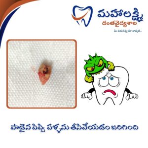 Business Name Mahalakshmi Dental Clinic | Best Dentist, Orthodontic , Dental Implant & Root Canal Centre in Khanapur - Nirmal - Adilabad Address: AMK Function Hall, Road, beside Katta Rajanna Oil Mill & Kirana store, beside Lucky Ladies Emporium, Khanapur, Telangana 504203 Phone: 9502211812,9502811812 Keywords: Mhalakshmi dental clinic in khanapur Mahalakshmi dental clinic in khanapur, Nirmal. Best dental clinics in Khanapur Best Dental Hospitals in Khanapur Top Dentists in Khanapur Best Endodontist Doctors in khanapur Best root canal doctor in khanapur Best maxillofacial surgeon in khanapur Best implantalogist in khanapur Best orthodontist in khanapur Dental hospital near me in khanapur Dental clinic near me in khanapur Top Dental clinic in Khanapur Best Dentist in Khanapur Best Root canal centre in khanapur Best Implant centre in khanapur Best Teeth cleaning clinic in khanapur Best Teeth Whitening clinic in khanapur Best Teeth Extraction clinic in khanapur Best Surgical Extraction clinic in khanapur Best Wisdom tooth Extraction clinic in khanapur Best cement filling clinic in khanapur Best children dental clinic in khanapur Best children dentist in khanapur Best Dental surgeon in khanapur Experienced dentist in khanapur Experienced dental clinic in khanapur Experienced root canal specialist in khanapur Best Root canal centre in khanapur Top Dental Services in khanapur Affordable Dental Implants in khanapur Root Canal Specialist in khanapur Teeth Whitening in khanapur Cosmetic Dentist in khanapur Orthodontistin khanapur Emergency Dental Care in khanapur Family Dentist in khanapur Pediatric Dentist in khanapur Gum Disease Treatment in khanapur clips treatment in khanapur Braces treatment in khanapur Dental Crown and Bridges Hanmakonda Smile Makeover in khanapur Dental Surgery in khanapur Wisdom Teeth Removal in khanapur Dental Implant Surgery in khanapur Dental Health Checkup in khanapur Porcelain Veneersin khanapur Sensitive Teeth Treatment in khanapur Dental Pain Relief in khanapur Dentures in khanapur Dental Fillings in khanapur Advanced Dental Care in khanapur Laser Dentistryin khanapur Dental Care for Seniors in khanapur Description: "Welcome to Mahalakshmi Dental Clinic Khanapur, your premier dental clinic in Khanapur 504203. We specialize in comprehensive dental treatments to ensure your oral health stays top-notch. From routine cleanings and dental check-ups to more advanced procedures like root canal treatments and tooth extractions, our expert team is dedicated to providing the highest standard of care. We also excel in restorative and cosmetic dentistry, helping you achieve a pearly white, confident smile. Using state-of-the-art technology and personalized care plans, Mahalakshmi Dental Clinic Khanapur is committed to your dental health. Visit us for professional, reliable, and affordable dental care in Khanapur ,Nirmal 504203." Facebook: https://www.facebook.com/mahalakshmidentalclinic/ https://www.facebook.com/mahalakshmidental/ Instagram: https://www.instagram.com/mahalakshmidental_khanapur/ THreads: https://www.threads.net/@mahalakshmidental_khanapur Youtube: https://www.youtube.com/@mahalakshmidentalclinic Website : https://mahalakshmidentalclinics.in/ telegram https://t.me/mahalakshmidentalclinic Google maps: https://www.google.com/maps/place/Mahalakshmi+Dental+Clinic+Khanapur+%7C+Best+Dental+Clinic,+Root+Canal+%26+Implant+Centre+in+Khanapur/@19.0407257,78.6510343,16z/data=!4m6!3m5!1s0x3bcd836b81589adb:0x92b6bc623dc1a56e!8m2!3d19.0401422!4d78.6504285!16s%2Fg%2F11vzs6bvmb?entry=ttu Shuru: https://shuru.co.in/services/dental-clinic-in-khanapur-nirmal